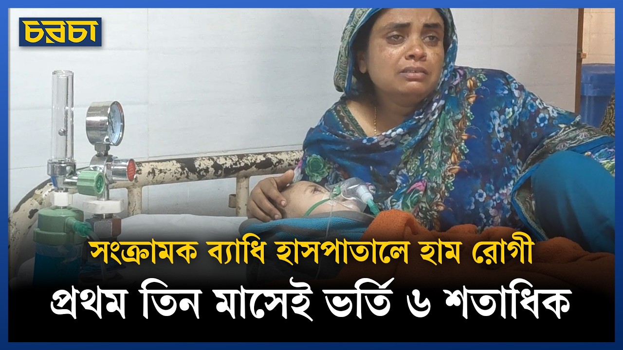 হামের রোগী বেড়েই চলেছে সংক্রামক ব্যাধি হাসপাতালে