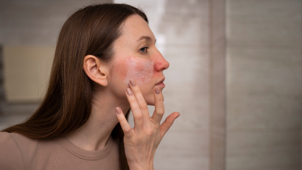 Skin rashes